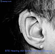 BTE Hearing Aid Behind the Ear Close-up