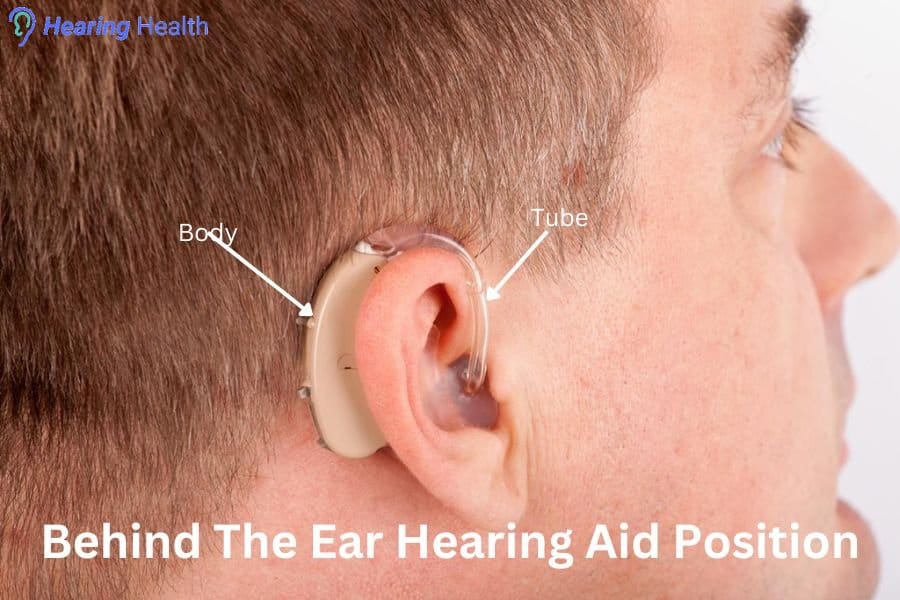 Behind-The-Ear_(BTE)_Hearing_Aids_position