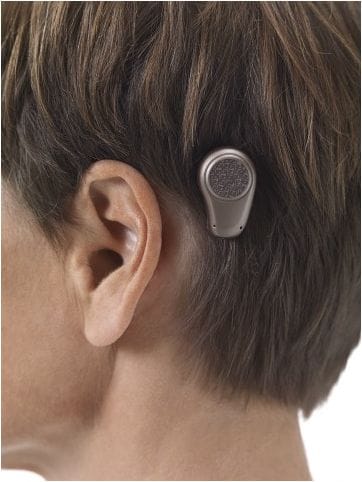 Bone-Anchored_Hearing_Aid_(BAHA)