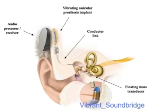 Vibrant_Soundbridge Vibrant_Soundbridge
