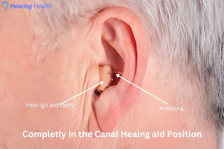 completely_in_the_canal_hearing_aid_position